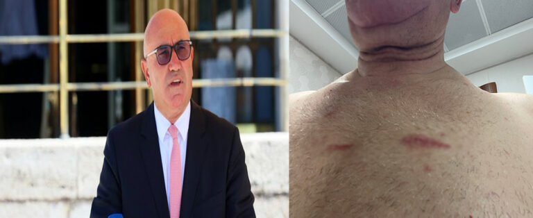 Tanal: “Bu Yaralar Sadece Bedende Değil, Hukuk Devletinde Açılmıştır!”