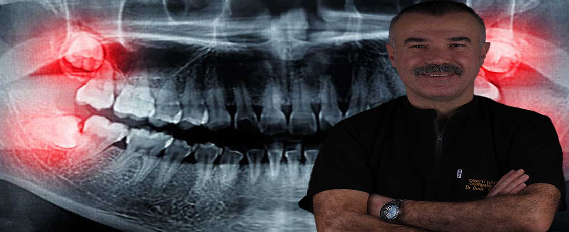 Uzman Uyardı: Gülüşünüz  Bozulabilir!