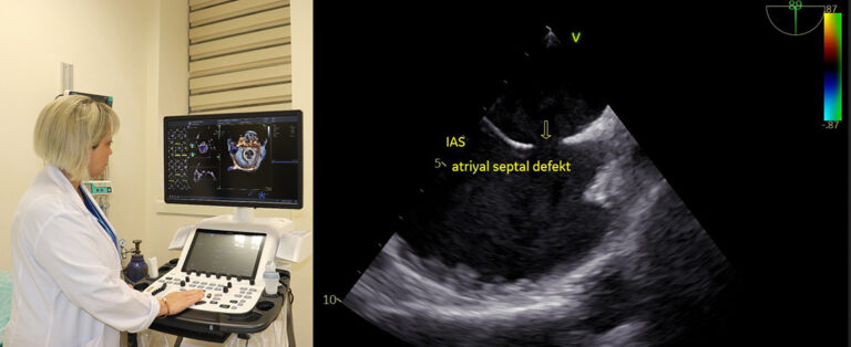 Harran Üniversitesi Kardiyoloji Kliniği, Yüksek Teknolojiyle Kalp Sağlığında Çığır Açıyor!